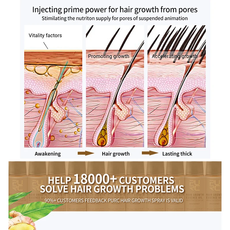 Fast Hair Growth Spray for Men Herbal Hair Growth Accelerator Hair Treatment 30ml BFC996
Fast Hair Growth Spray for Men Herbal Hair Growth Accelerator Hair Treatment 30ml BFC996