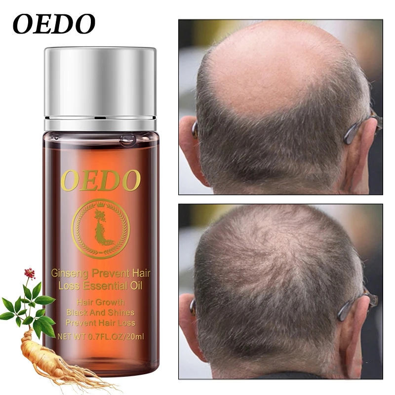 

20ml Ginseng Hair Growth Essence Preventing Hair Loss Essential Oil Repair Damage Hair Nourish Hair Roots Accelerate Hair Growth