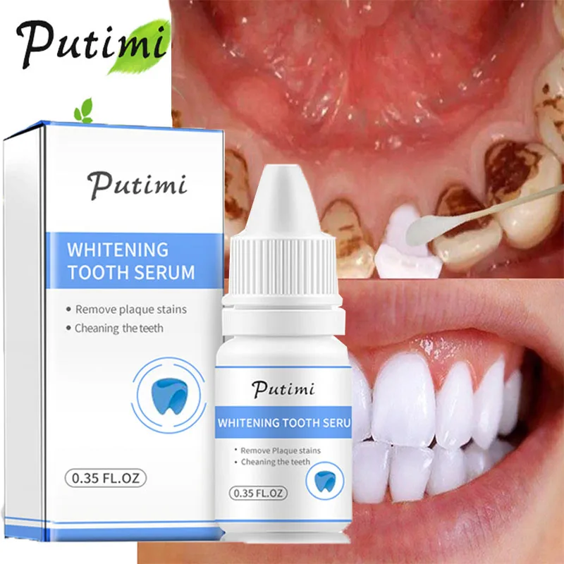 Teeth Whitening Serum Effective Remove Smoke Coffee Plaque Stains Clean Oral Hygiene Bleaching Tooth Fresh Breath Dental Tools
Teeth Whitening Serum Effective Remove Smoke Coffee Plaque Stains Clean Oral Hygiene Bleaching Tooth Fresh Breath Dental Tools