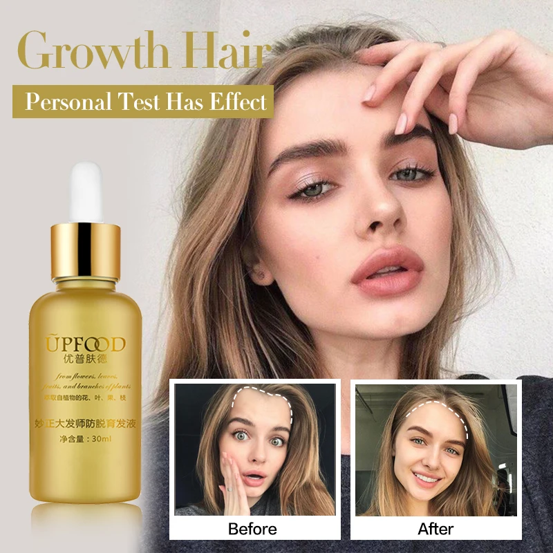 Hair Growth Oil Natural Plant Extract Serum Anti Hair Loss Essence Scalp Treatments Effective Regrow Hair Care Product for Women 
Hair Growth Oil Natural Plant Extract Serum Anti Hair Loss Essence Scalp Treatments Effective Regrow Hair Care Product for Women