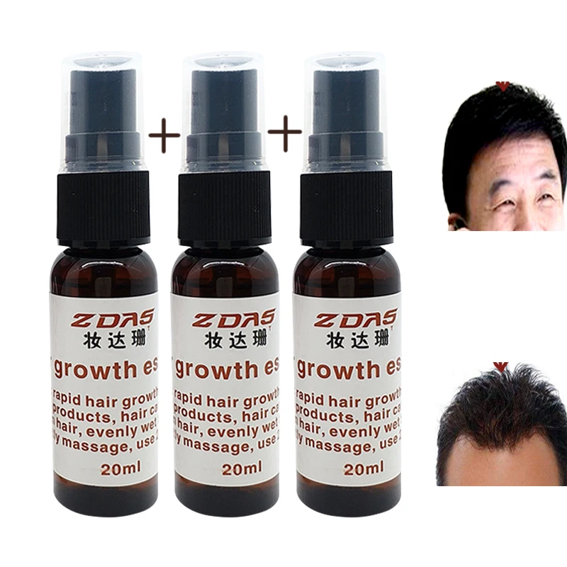 3pc Anti-hair loss Products germinal dense hair liquid medicine fast hair growth agent seborrheic essential serum Free shipping
3pc Anti-hair loss Products germinal dense hair liquid medicine fast hair growth agent seborrheic essential serum Free shipping
