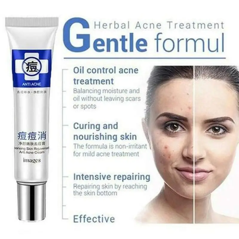 30g Acne Treatment Blackhead Remova Anti Acne Cream Oil Control Shrink Pores Acne Scar Remove Face Skin Care Whitening Cream
30g Acne Treatment Blackhead Remova Anti Acne Cream Oil Control Shrink Pores Acne Scar Remove Face Skin Care Whitening Cream
