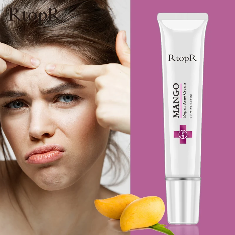 Acne Treatment Face Cream Blackhead Repair Oil Control Shrink Pores Scar Moisturizer Skin Care Korean Cosmetics Whitening Creams
Acne Treatment Face Cream Blackhead Repair Oil Control Shrink Pores Scar Moisturizer Skin Care Korean Cosmetics Whitening Creams