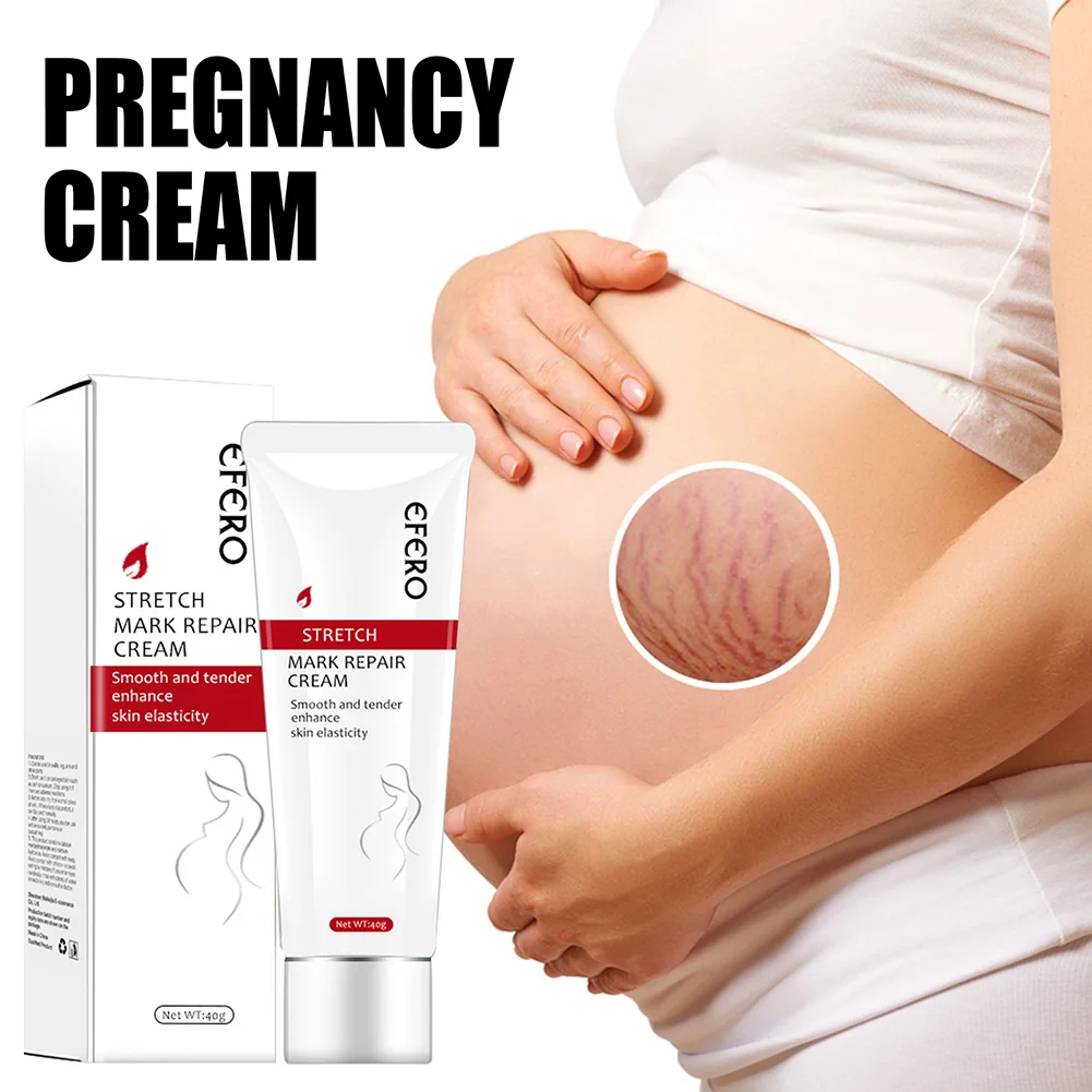 Stretch Marks Repair Cream Postpartum Obesity Pregnancy Body Marks Acne Scars Removal Cream for Soft Tender Skin Body Care
Stretch Marks Repair Cream Postpartum Obesity Pregnancy Body Marks Acne Scars Removal Cream for Soft Tender Skin Body Care