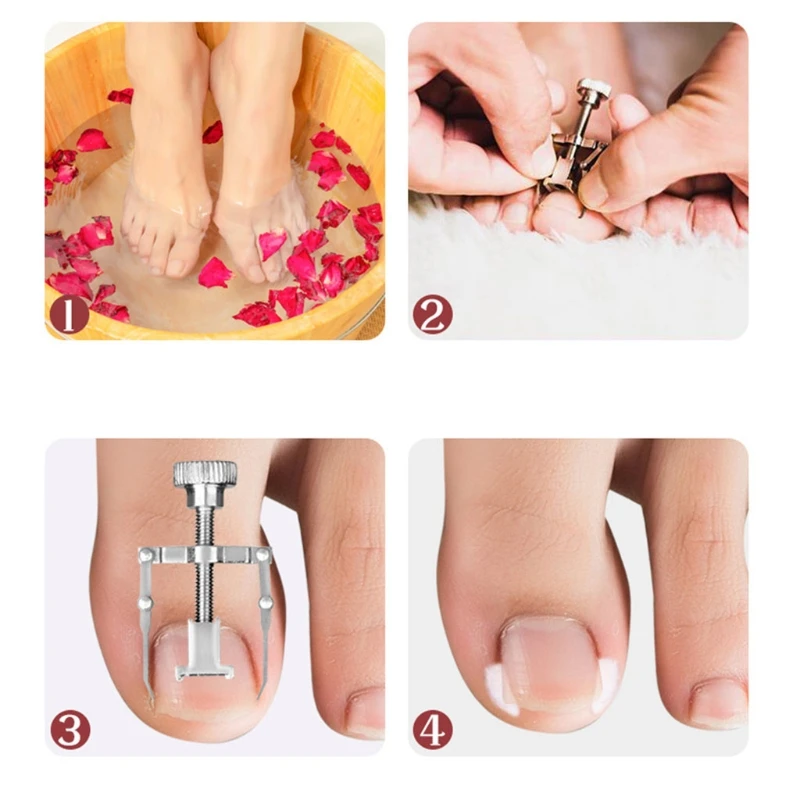 Podiatrist Toenail Clipper Professional Thick Ingrown Toe Nail Clippers for Men Seniors Pedicure Clippers Toenail Cutter 
Podiatrist Toenail Clipper Professional Thick Ingrown Toe Nail Clippers for Men Seniors Pedicure Clippers Toenail Cutter