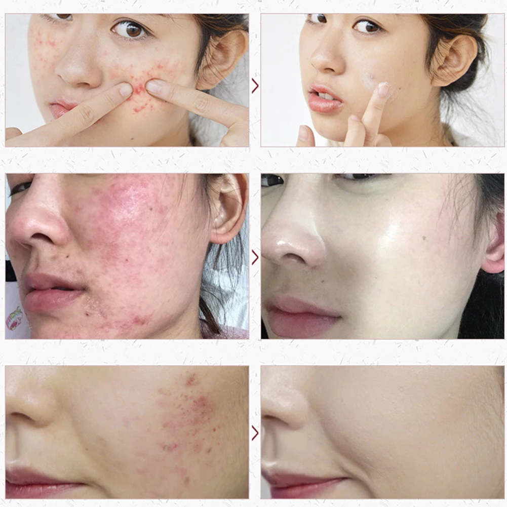 Comfortable Cheese Soap Moisturizing Oil-control Soap Multi-functional Practical Sea Salt Soap Cleaner Facing Care
Comfortable Cheese Soap Moisturizing Oil-control Soap Multi-functional Practical Sea Salt Soap Cleaner Facing Care