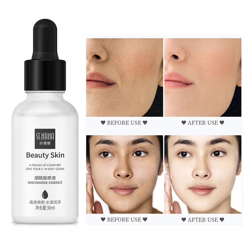 Niacinamide Whitening Facial Essence Deep Moisturizing Anti-acne Serum Repairs Skin Prevents Melanin Brighten Skin Care Liquid
Niacinamide Whitening Facial Essence Deep Moisturizing Anti-acne Serum Repairs Skin Prevents Melanin Brighten Skin Care Liquid