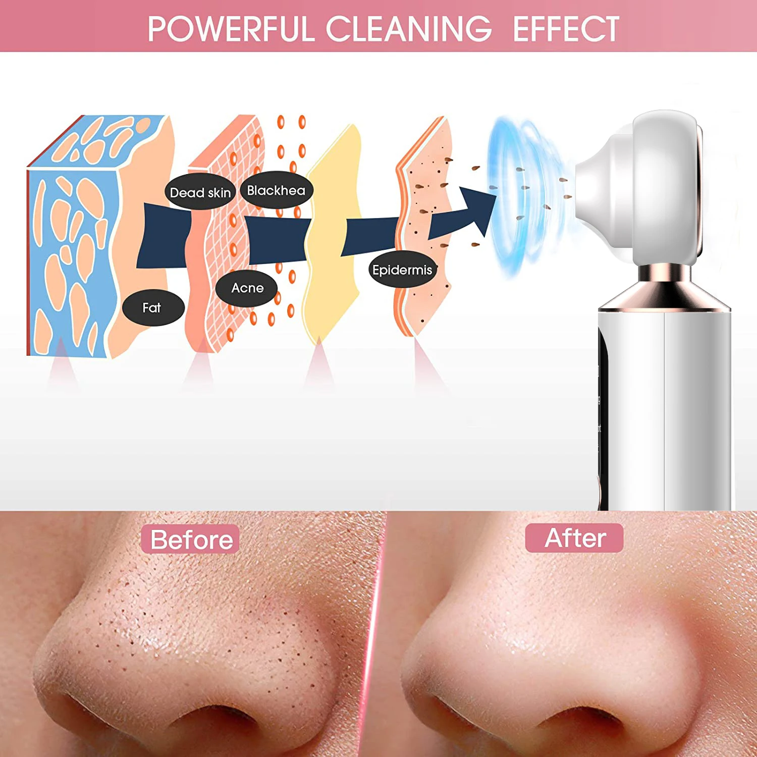 Blackhead Remover Vacuum Pore Cleaner Acne Remover Electric Heating Nose Face Deep Cleansing WIFI Microscope with Led Light
Blackhead Remover Vacuum Pore Cleaner Acne Remover Electric Heating Nose Face Deep Cleansing WIFI Microscope with Led Light