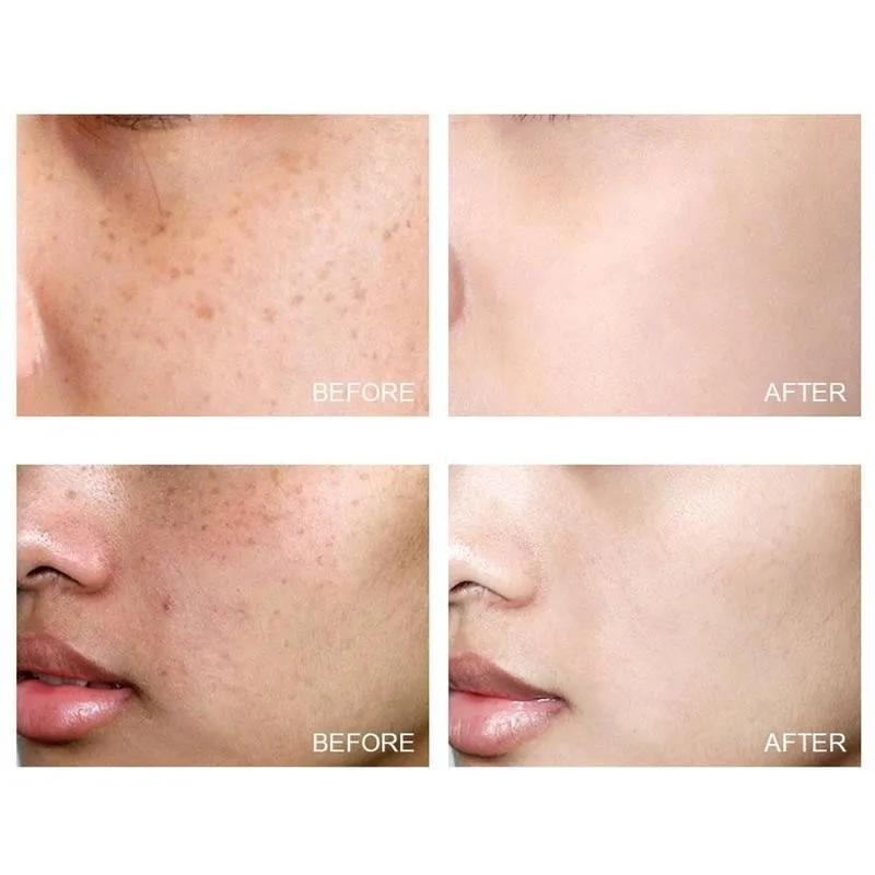 Vitamin C Cream Moisturizing Whitening Brighten Anti Remove Anti Fineline Aging Cream Skin Care K1C3
Vitamin C Cream Moisturizing Whitening Brighten Anti Remove Anti Fineline Aging Cream Skin Care K1C3