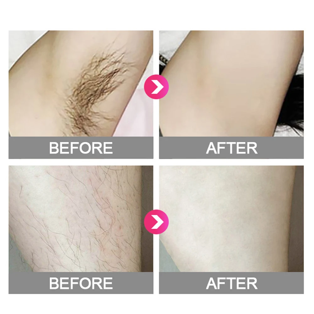 990000 Flash Professional Permanent Laser Epilator LCD Display Laser IPL Hair Removal Machine Photoepilator Painless Depilador
990000 Flash Professional Permanent Laser Epilator LCD Display Laser IPL Hair Removal Machine Photoepilator Painless Depilador