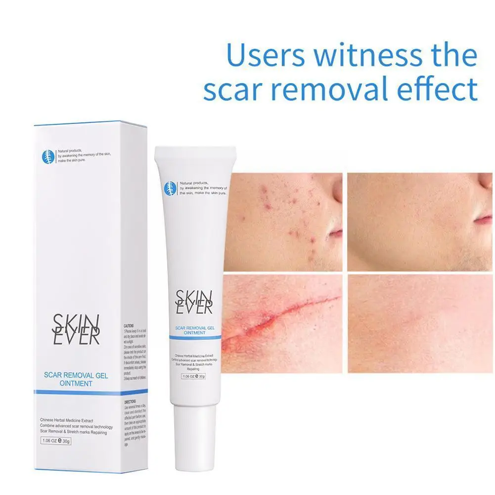20g Scar Cream Gel Stretch Marks Acne Scald Scar Removal Cream Cream Skin Moisturizing Cream Body Whitening Silky T2G3
20g Scar Cream Gel Stretch Marks Acne Scald Scar Removal Cream Cream Skin Moisturizing Cream Body Whitening Silky T2G3