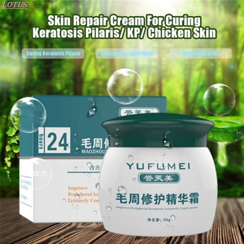 Curing Keratosis Pilaris/ Kp/ Chicken Skin Body Lotion Skin Repair Cream Skin Care Essence Moisturizing And Nourishing 50g
Curing Keratosis Pilaris/ Kp/ Chicken Skin Body Lotion Skin Repair Cream Skin Care Essence Moisturizing And Nourishing 50g