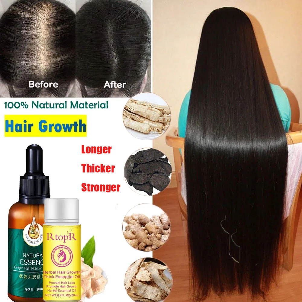 Ginger Hair Growth Essence Fast Thick For Anti-Hair Loss Damaged Hair Repair Longer Thicker Natural Hair Care Product 30ML
Ginger Hair Growth Essence Fast Thick For Anti-Hair Loss Damaged Hair Repair Longer Thicker Natural Hair Care Product 30ML