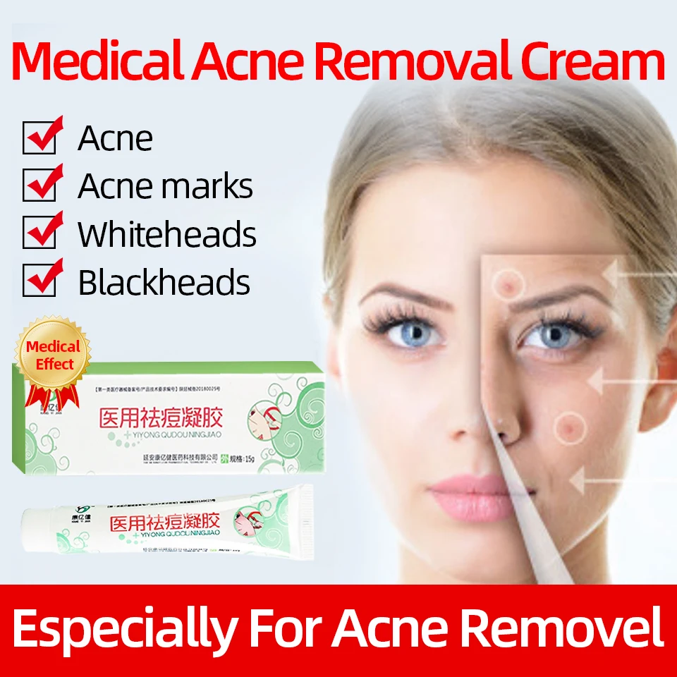 Anti Acne Medical Ointment Improve Pimple Marks Repair Scars Face Skin Care Cream
Anti Acne Medical Ointment Improve Pimple Marks Repair Scars Face Skin Care Cream