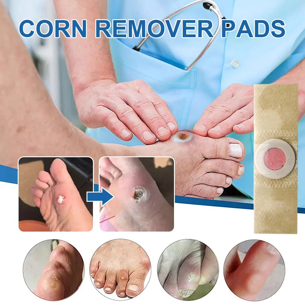 New Upgrade Corn Remover Pads Safe Effective Corn Treatment Pads Relieve Foot Pain Toe Small and compact Callus Removal Pads
New Upgrade Corn Remover Pads Safe Effective Corn Treatment Pads Relieve Foot Pain Toe Small and compact Callus Removal Pads