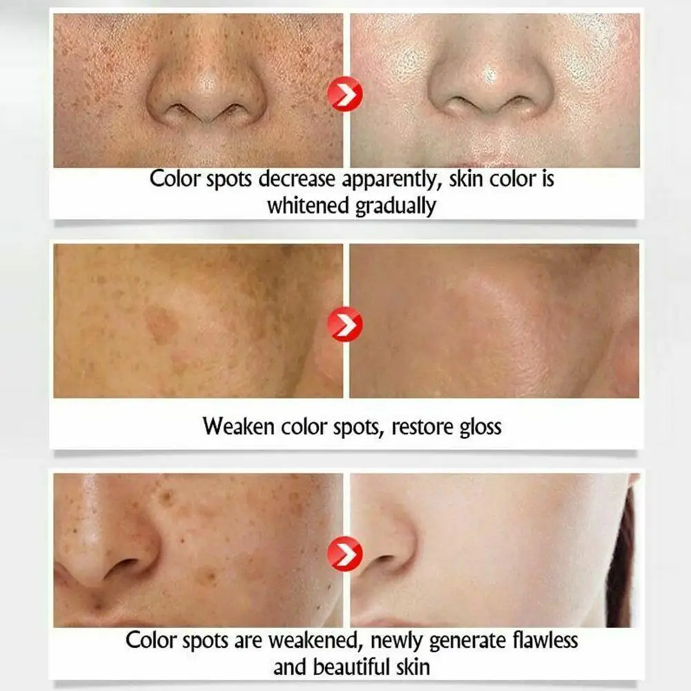 Freckle Whitening Cream 25g Powerful Spot Remover Anti Aging Moisturizer Face Dark Day Cream Cream Beauty Spots Fade M6R0
Freckle Whitening Cream 25g Powerful Spot Remover Anti Aging Moisturizer Face Dark Day Cream Cream Beauty Spots Fade M6R0