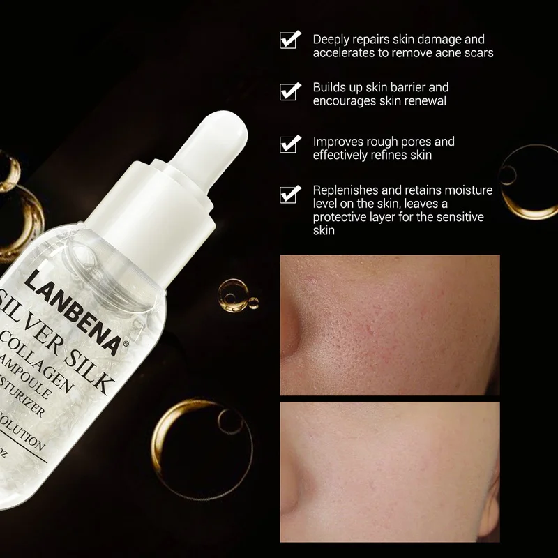 Silkworm Wire Protein Essence Snail Lotion Pore Moisturizing Skin Care Replenish and Maintain Moisture Refreshing and Not Sticky
Silkworm Wire Protein Essence Snail Lotion Pore Moisturizing Skin Care Replenish and Maintain Moisture Refreshing and Not Sticky