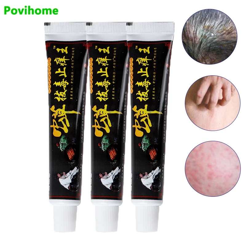 1/3pcs Relieve Itching Treatment Eczema Psoriasis Dermatitis Ointment Traditional Chinese Medicine Herbal Cream Skin Problems
1/3pcs Relieve Itching Treatment Eczema Psoriasis Dermatitis Ointment Traditional Chinese Medicine Herbal Cream Skin Problems