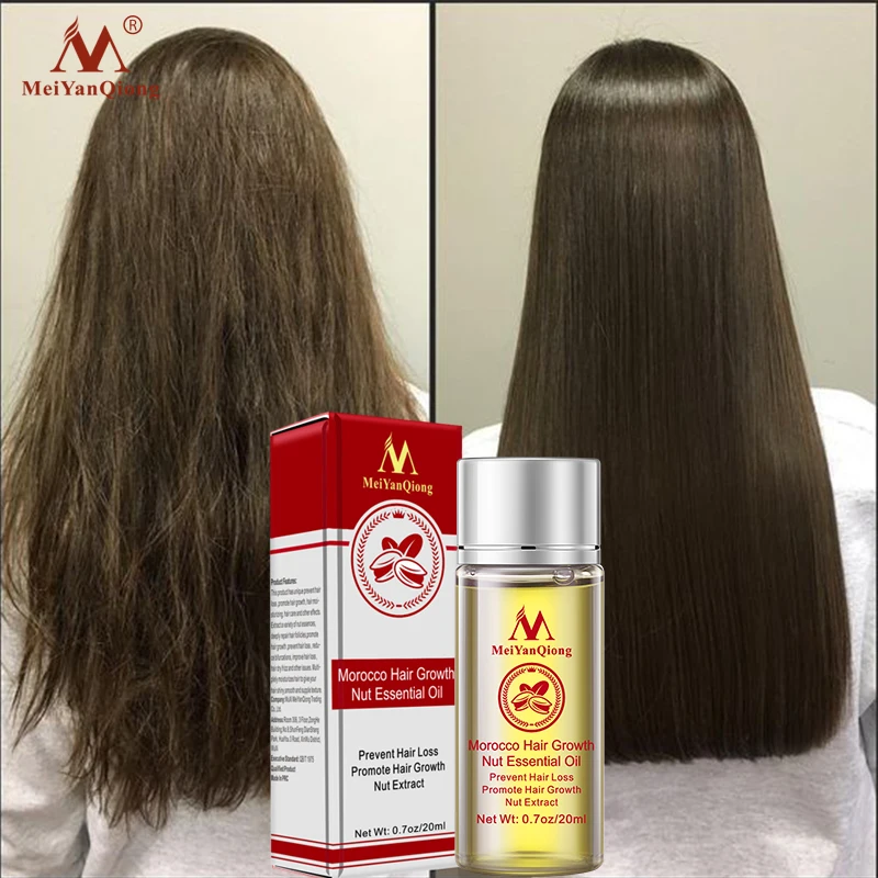 MeiYanQiong Moroccan Care Oil Nourishes Shiny Hair To Help Grow Faster And Make Hair More Flexible Hair Care Improve Dry
MeiYanQiong Moroccan Care Oil Nourishes Shiny Hair To Help Grow Faster And Make Hair More Flexible Hair Care Improve Dry