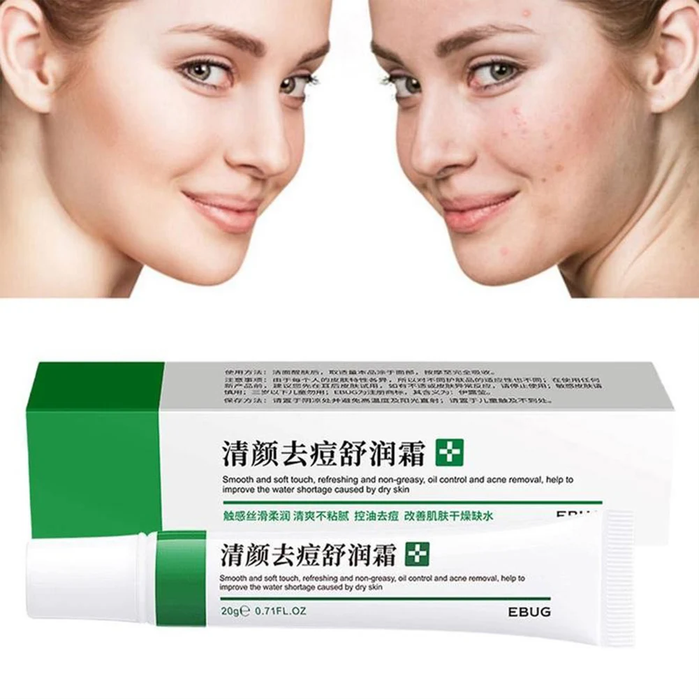Effective Treatment Of Acne Cream Fade Out Pores Control Oil, Reduce Acne, Moisturize Skin Care Oil Control And Acne Elimination
Effective Treatment Of Acne Cream Fade Out Pores Control Oil, Reduce Acne, Moisturize Skin Care Oil Control And Acne Elimination