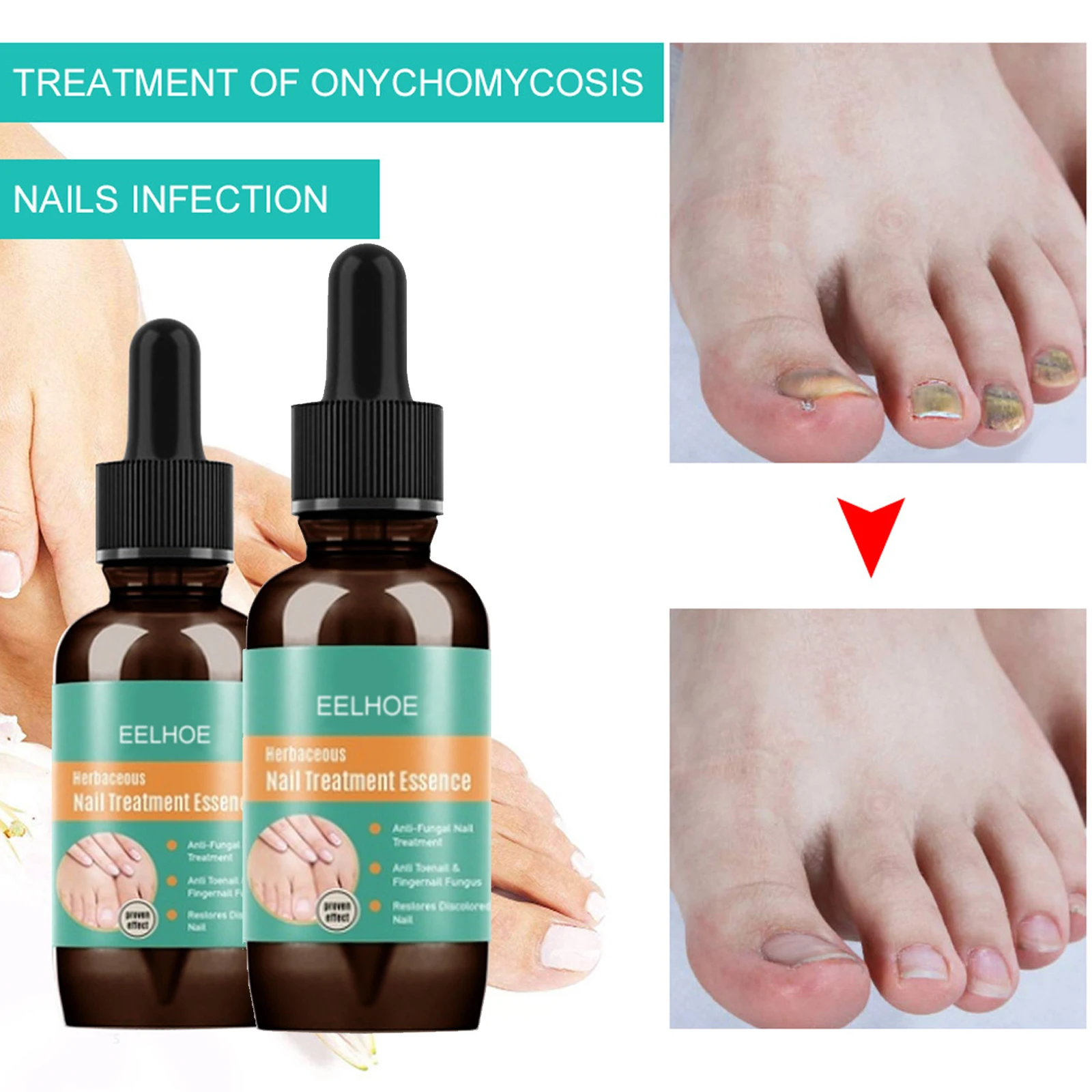 1Pc Effect Fungus Removal Essence Liquid Fungal Nail Treatment Bright Nail Repair Anti Infection Foot Caring Plasters
1Pc Effect Fungus Removal Essence Liquid Fungal Nail Treatment Bright Nail Repair Anti Infection Foot Caring Plasters