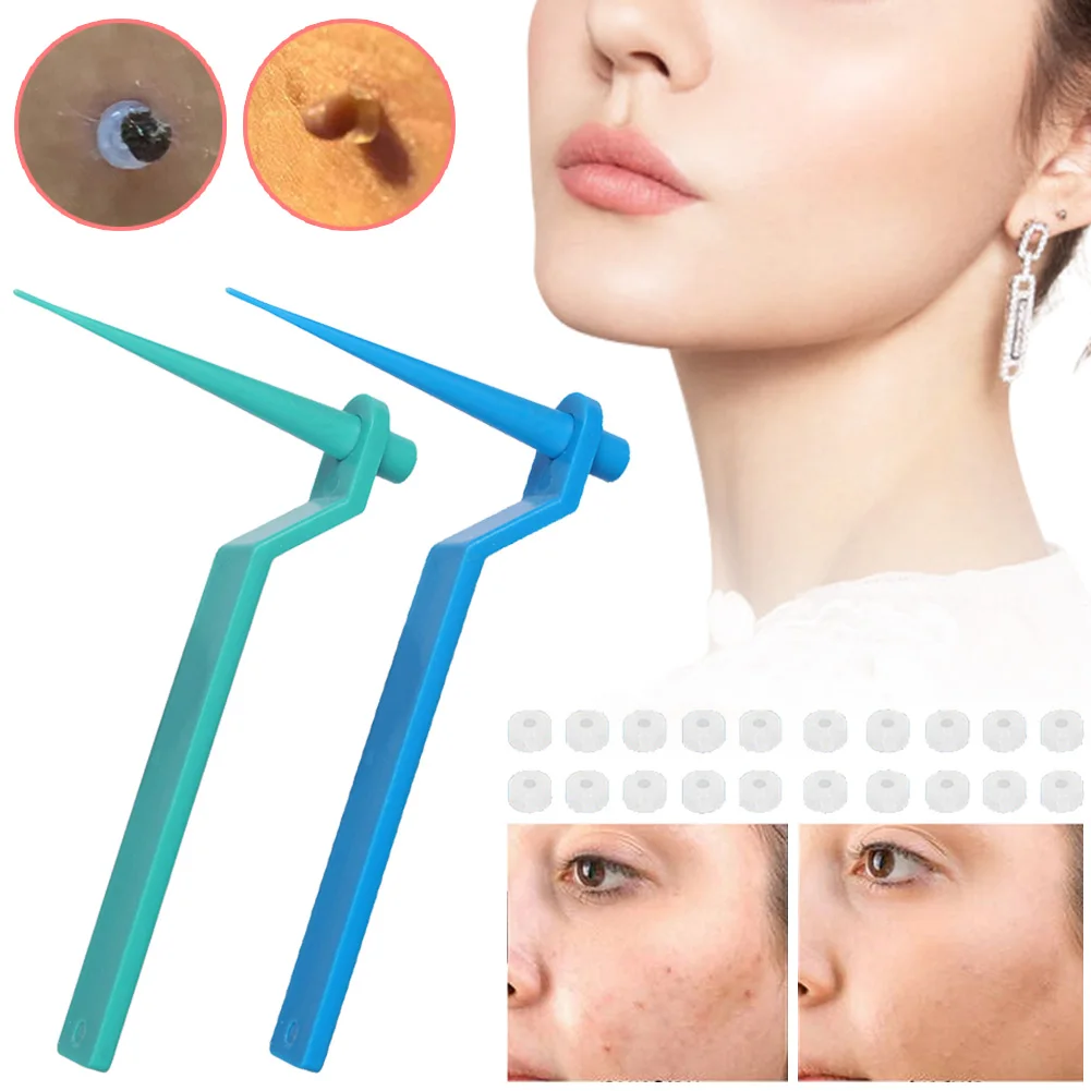 Skin Tag Remover Tool Kit for Small to Medium Sized Skin Tags with 20 Rubber Bands, 10 Cleansing Wipes for Face Body Fast Safe
Skin Tag Remover Tool Kit for Small to Medium Sized Skin Tags with 20 Rubber Bands, 10 Cleansing Wipes for Face Body Fast Safe