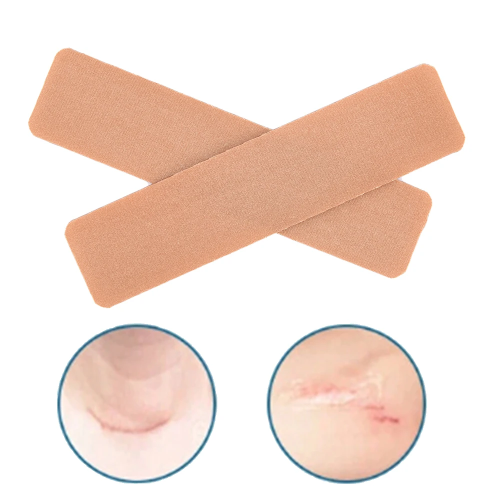 2pcs Scar Away Patch Silicone Gel Sheet Wound Marks Removal Cesarean Skin Scars First Aid Kits
2pcs Scar Away Patch Silicone Gel Sheet Wound Marks Removal Cesarean Skin Scars First Aid Kits