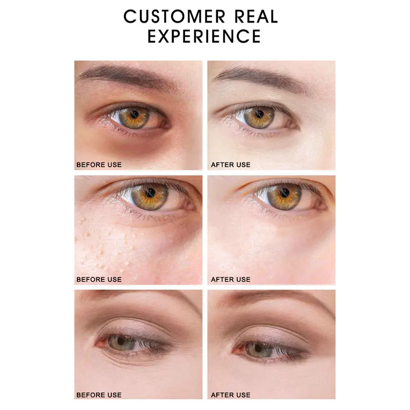 ARTISCARE Seaweed Eye Mask + Golden Eye Cream Anti-Wrinkle Anti-Aging Remover Dark Circles Eye Care Anti-Puffiness Moisturizing
ARTISCARE Seaweed Eye Mask + Golden Eye Cream Anti-Wrinkle Anti-Aging Remover Dark Circles Eye Care Anti-Puffiness Moisturizing