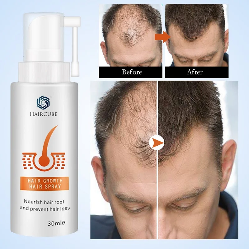 HAIRCUBE Stop Anti Hair Loss Fast Hair Growth Products For Men Woman Hair Growth Spray Essential Oil Liquid Essence Regeneration
HAIRCUBE Stop Anti Hair Loss Fast Hair Growth Products For Men Woman Hair Growth Spray Essential Oil Liquid Essence Regeneration