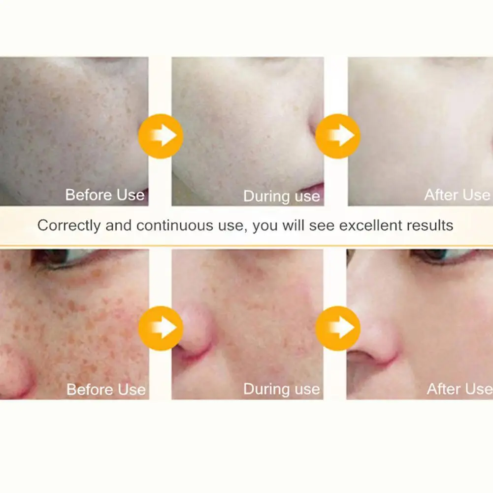 Lemon Morning And Night Cream Fades Melanin, Improves Deeply Moisturizes Anti-aging Cream Dull And Hydrates Complexion, H0A6
Lemon Morning And Night Cream Fades Melanin, Improves Deeply Moisturizes Anti-aging Cream Dull And Hydrates Complexion, H0A6