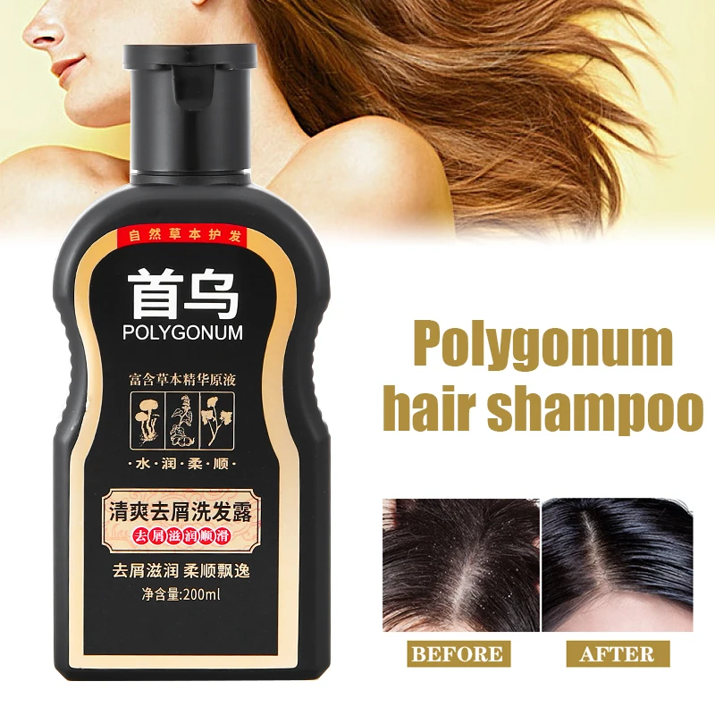 

200ml Polygonum Natural Plant Hair Shampoo Hair Care Anti-Dandruff Improve Scalp Itching Problem For All Hair Types