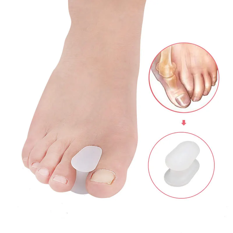 2-6Pair Bunion Corrector Hallux Valgus Correction Toe Separator Orthopedic Big Toe Straightener Protector Feet Care Tools
2-6Pair Bunion Corrector Hallux Valgus Correction Toe Separator Orthopedic Big Toe Straightener Protector Feet Care Tools