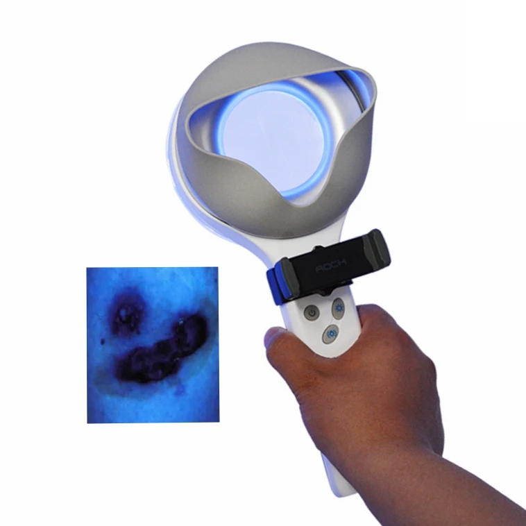 KN-9000B portable LED dermatology examination Woods Lamp medical magnifier skin analyzer
KN-9000B portable LED dermatology examination Woods Lamp medical magnifier skin analyzer