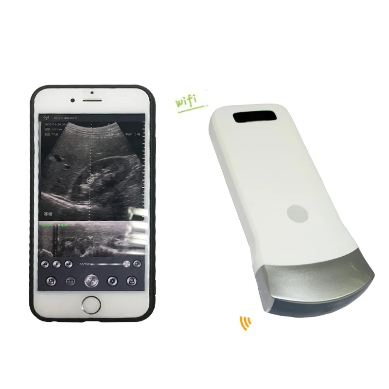Buy Pocket Wireless Ultrasound Scanner Veterinary Medical Physiotherapy Portable Ultrasound 4D Scan Therapy Machine Gel Price
Buy Pocket Wireless Ultrasound Scanner Veterinary Medical Physiotherapy Portable Ultrasound 4D Scan Therapy Machine Gel Price