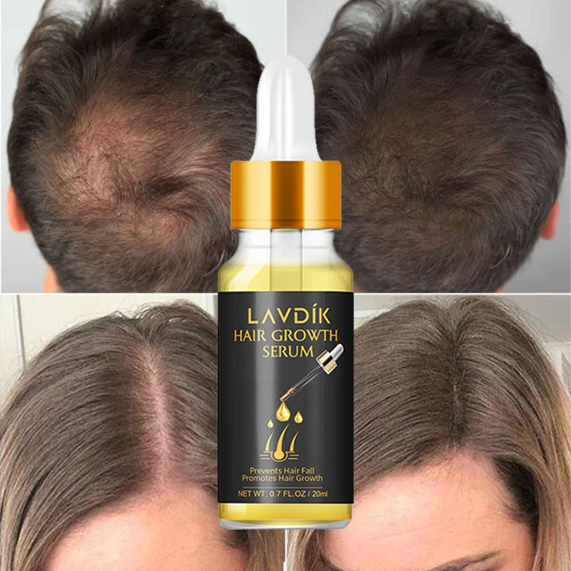 

Women Men Care Hair Growth Serum Ginger Hair Loss Treatment Oil Nourishing Repairing Damaged Hair Regrowth Essence Oil 20ml
