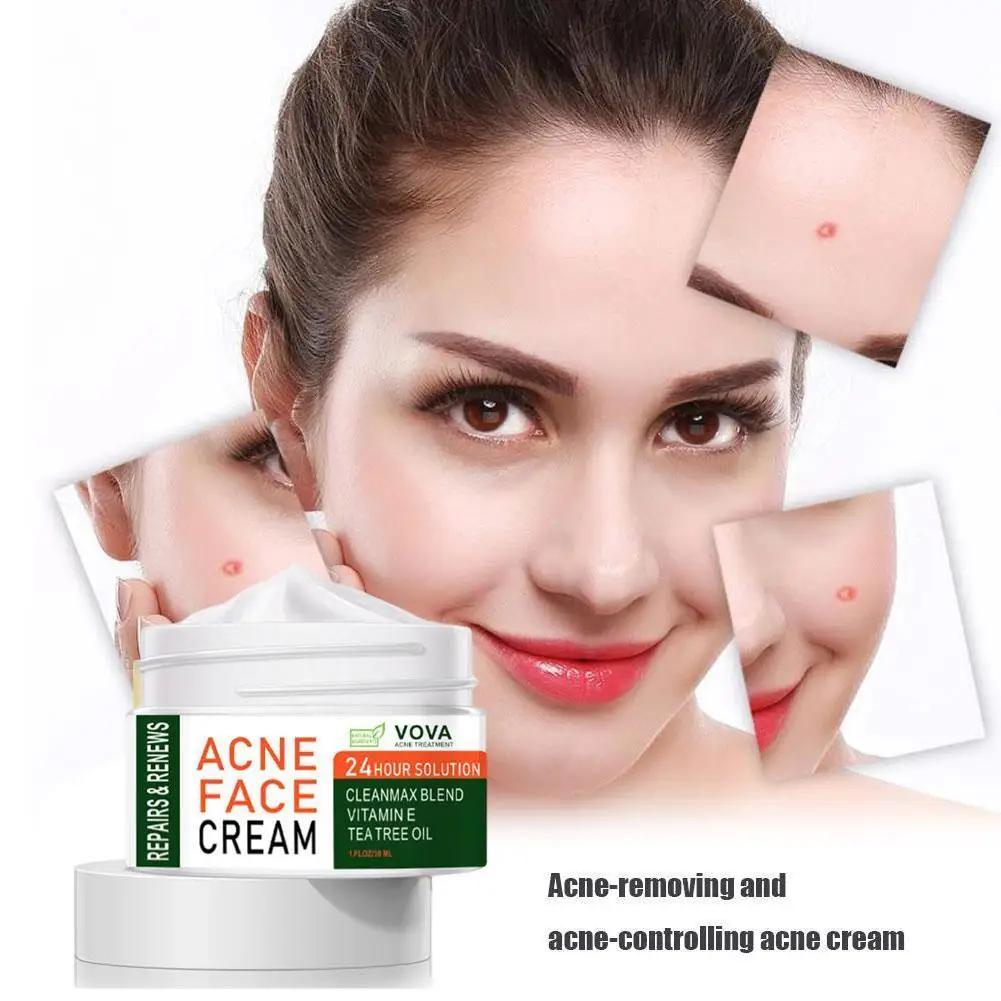 Strong Remove Acne Pimple Whitening Cream Remove Melanin Skin Pimple Cream Care Essence Tool T1E9
Strong Remove Acne Pimple Whitening Cream Remove Melanin Skin Pimple Cream Care Essence Tool T1E9