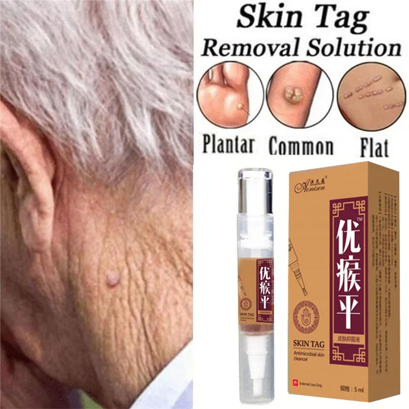 Skin Tag Remover Pen 12 hours Tu kill Medical Tu kill Remover Skin Tag Mole & Genital Wart Remover Foot Corn Removal Pen
Skin Tag Remover Pen 12 hours Tu kill Medical Tu kill Remover Skin Tag Mole & Genital Wart Remover Foot Corn Removal Pen