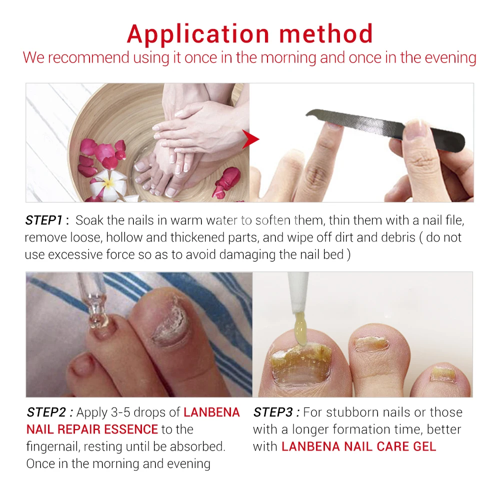 LANBENA Nail Care Gel Fungal Nail Treatment Remove Onychomycosis Nail Care Nourishing Effective against nail Hand And Foot Care
LANBENA Nail Care Gel Fungal Nail Treatment Remove Onychomycosis Nail Care Nourishing Effective against nail Hand And Foot Care