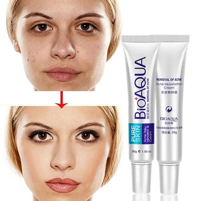 Acne Treatment Cream Blackhead Scar Remove Oil Control Shrink Pores Anti Face Serum Skin Whitening Moisturizing Gel 30g
Acne Treatment Cream Blackhead Scar Remove Oil Control Shrink Pores Anti Face Serum Skin Whitening Moisturizing Gel 30g