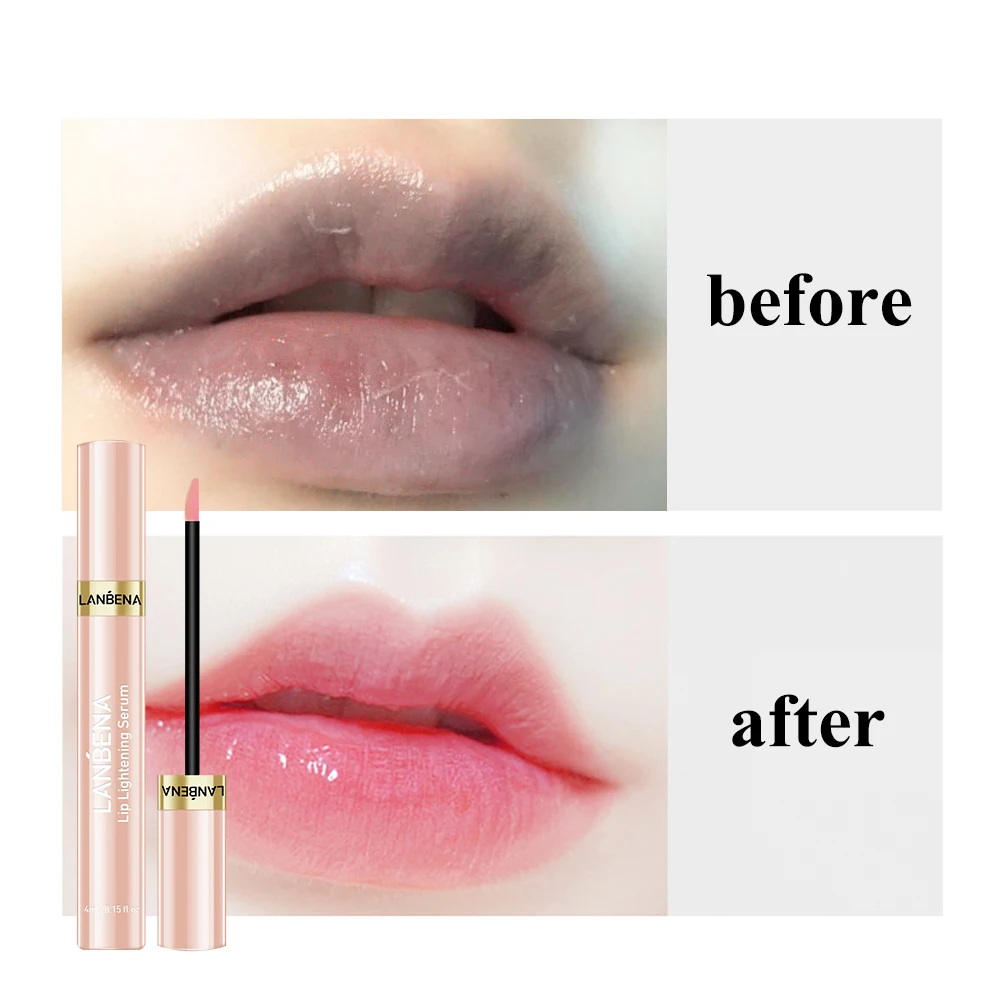 Fruit Lip Gloss Moisturizing Removing Melanin Lip Brighten Serum Arbutin Reduce Lip Pigmentation Ben Oil Antioxidation Lip Balm
Fruit Lip Gloss Moisturizing Removing Melanin Lip Brighten Serum Arbutin Reduce Lip Pigmentation Ben Oil Antioxidation Lip Balm