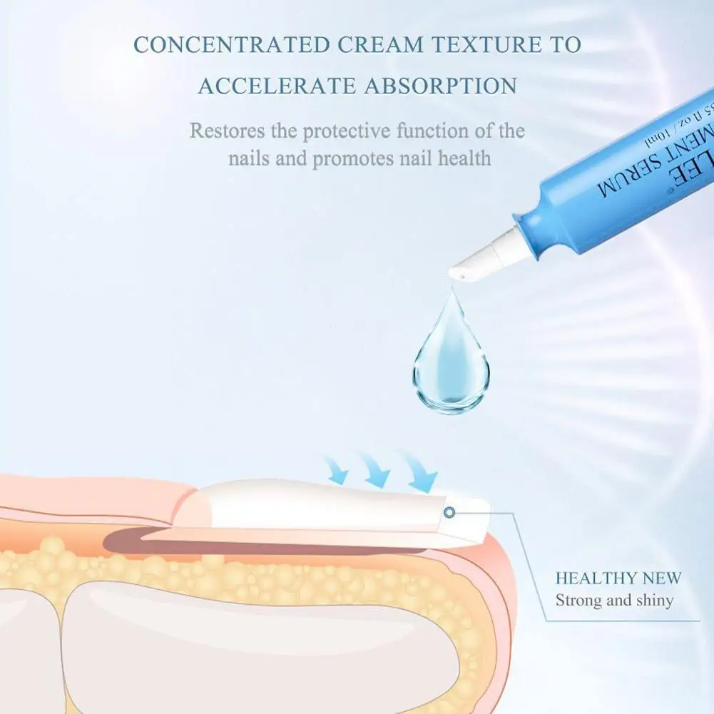 Nail Fungal Treatment Feet Care Essence Nail Foot Whitening Toenail Fungus Removal Gel Anti Infection Paronychia Repair Supplies
Nail Fungal Treatment Feet Care Essence Nail Foot Whitening Toenail Fungus Removal Gel Anti Infection Paronychia Repair Supplies