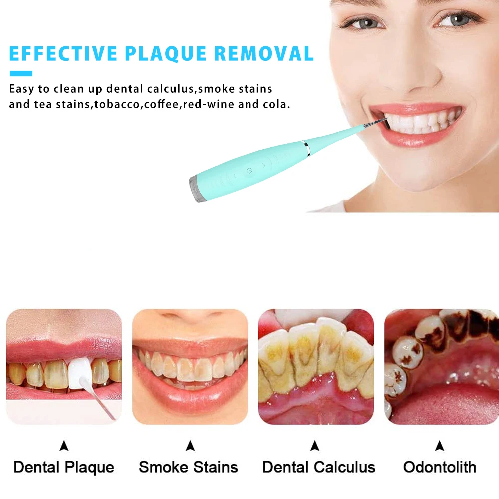 Smart Electric Ultrasonic Sonic Dental Scaler Tooth Calculus Remover Cleaner Tooth Stains Tartar Tool Whiten Teeth Tartar Remove
Smart Electric Ultrasonic Sonic Dental Scaler Tooth Calculus Remover Cleaner Tooth Stains Tartar Tool Whiten Teeth Tartar Remove