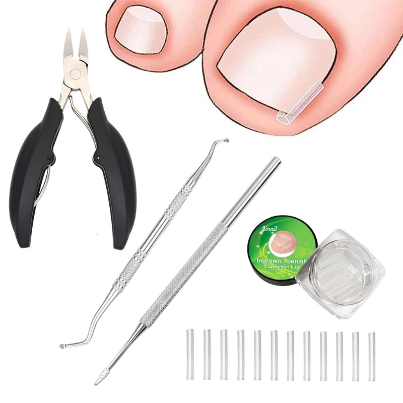 Дизайнерские ленты для поднятия вросших ногтей, Нескользящие кусачки для ногтей, 094E
Дизайнерские ленты для поднятия вросших ногтей, Нескользящие кусачки для ногтей, 094E