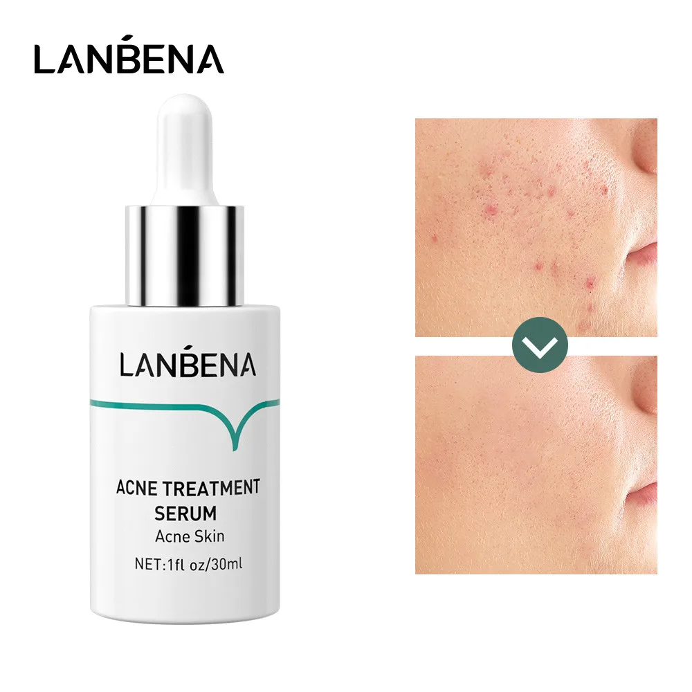 LANBENA, для лечения прыщей, Сыворотки Oilgopeptide против акне решение уменьшить Mark, уменьшает поры, глубокий ремонт укрепляют кожу нижней 30 мл
LANBENA, для лечения прыщей, Сыворотки Oilgopeptide против акне решение уменьшить Mark, уменьшает поры, глубокий ремонт укрепляют кожу нижней 30 мл