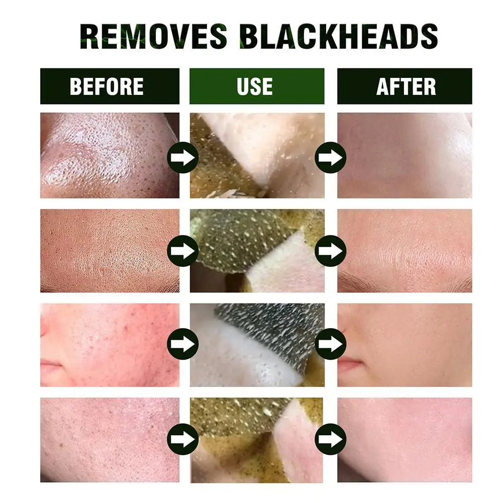 Green Tea Cleansing And Pulling Mask To Clear Acne Repair Soothe Blackheads Pores Mask Cleanse And To And B0W8
Green Tea Cleansing And Pulling Mask To Clear Acne Repair Soothe Blackheads Pores Mask Cleanse And To And B0W8