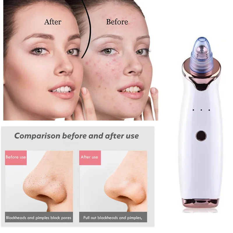 Blackhead Remover Face Tag Nose Cleaner +4Pcs Acne Needle Face Vacuum Suction Facial Deep Beauty Clean Skin Tool
Blackhead Remover Face Tag Nose Cleaner +4Pcs Acne Needle Face Vacuum Suction Facial Deep Beauty Clean Skin Tool