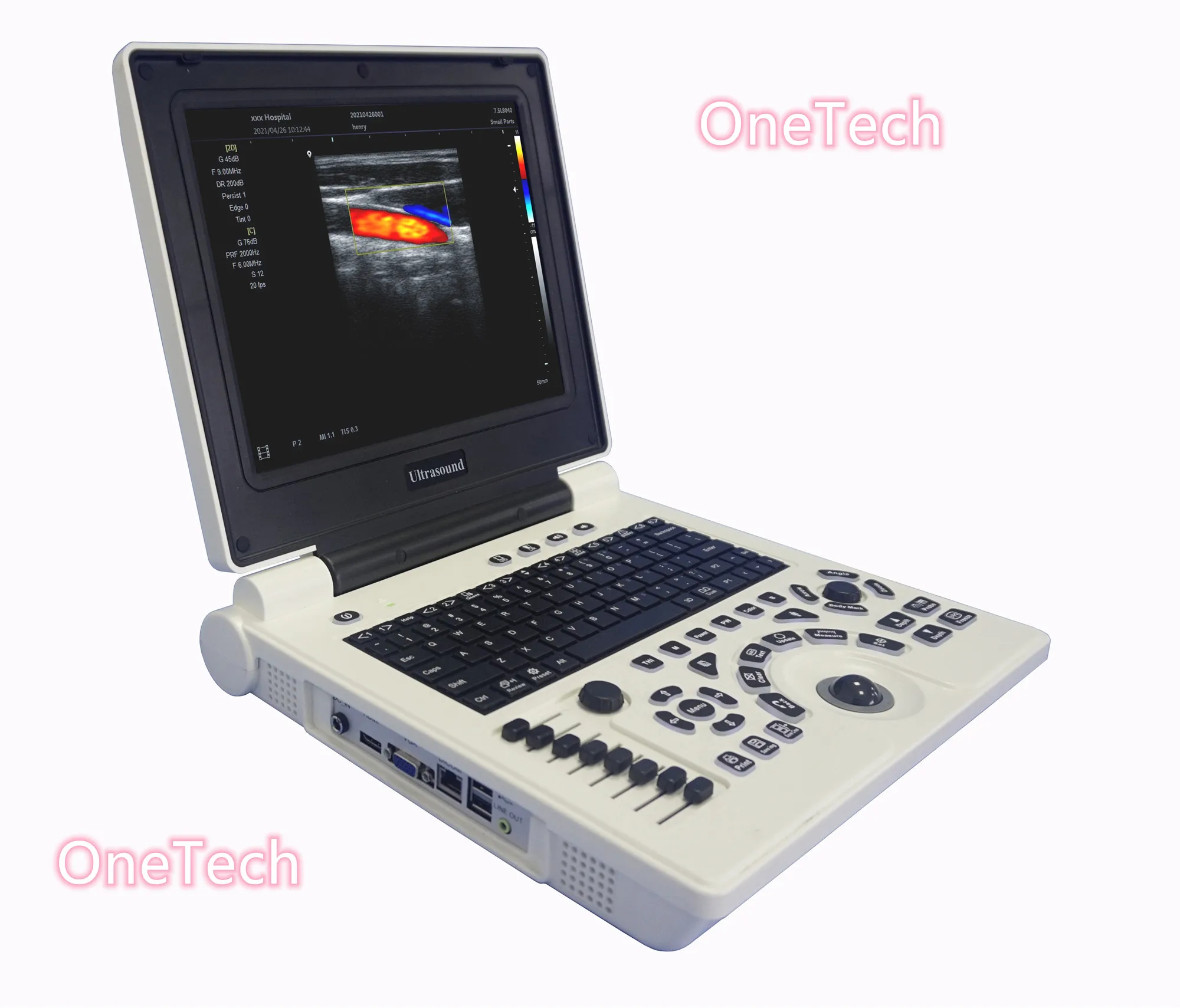 Professional hospital use full digital trolley or laptop type 3D color doppler ultrasound machine diagnose system C55-N
Professional hospital use full digital trolley or laptop type 3D color doppler ultrasound machine diagnose system C55-N