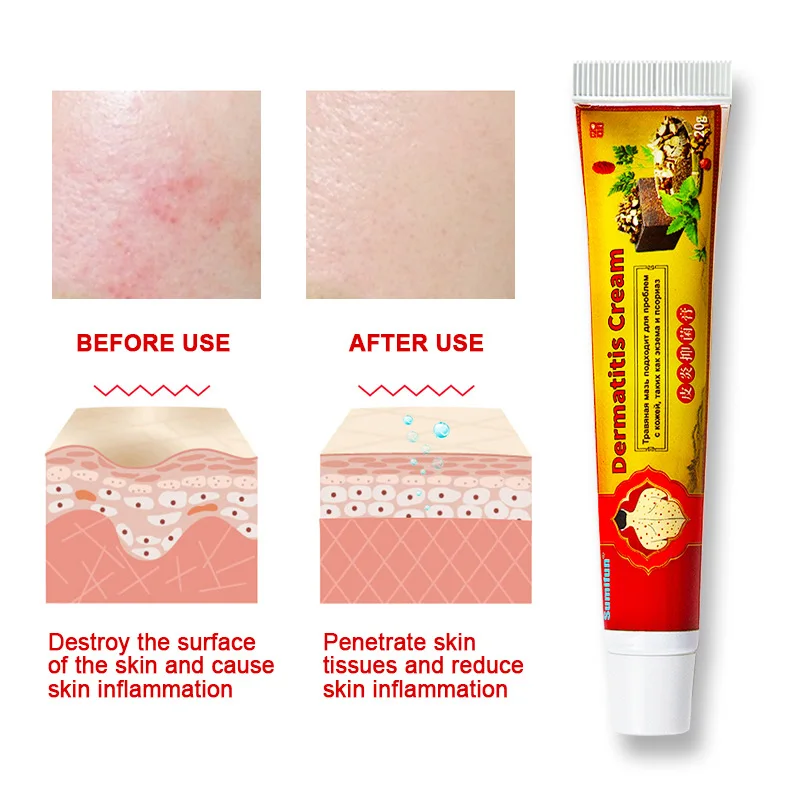 1pcs Sumifun Dermatitis Oinment Psoriasis Eczematoid Eczema Anti-itching Relief Pain Ointment Body Skin Chinese Herbal Cream 20g
1pcs Sumifun Dermatitis Oinment Psoriasis Eczematoid Eczema Anti-itching Relief Pain Ointment Body Skin Chinese Herbal Cream 20g
