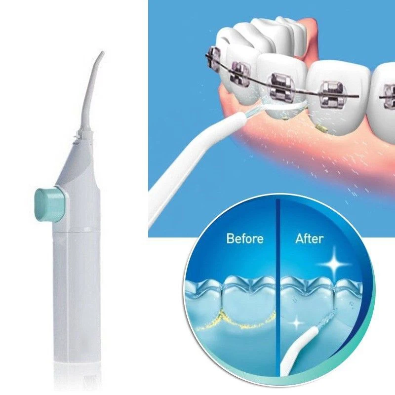 Jet Cleaning Tooth Mouth Denture Cleaner Irrigator Of the Oral Portable Dental Hygiene Floss water flosser | Бытовая техника