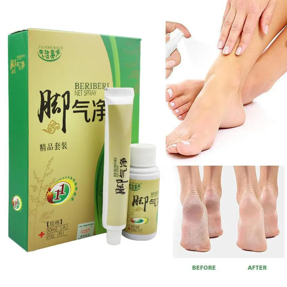 Anti Fungal Infections Foot Cream Treatment Athlete Foot Pain Relief Beriberi Itching Erosion Peeling Blisters Feet Ointment
Anti Fungal Infections Foot Cream Treatment Athlete Foot Pain Relief Beriberi Itching Erosion Peeling Blisters Feet Ointment